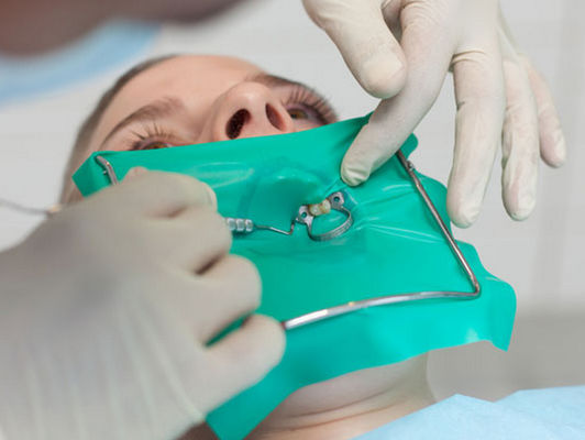 ราคาดี เขื่อนยางทันตกรรมบริสุทธิ์ วัสดุแก้มยาง Retractor แผ่นเขื่อนยาง ออนไลน์