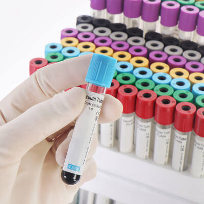 ราคาดี หลอดเลือด EDTA แบบสุญญากาศสำหรับตรวจนับเม็ดเลือดอย่างสมบูรณ์ (CBC) – คุณภาพสูง, ซีลแน่นหนา ออนไลน์